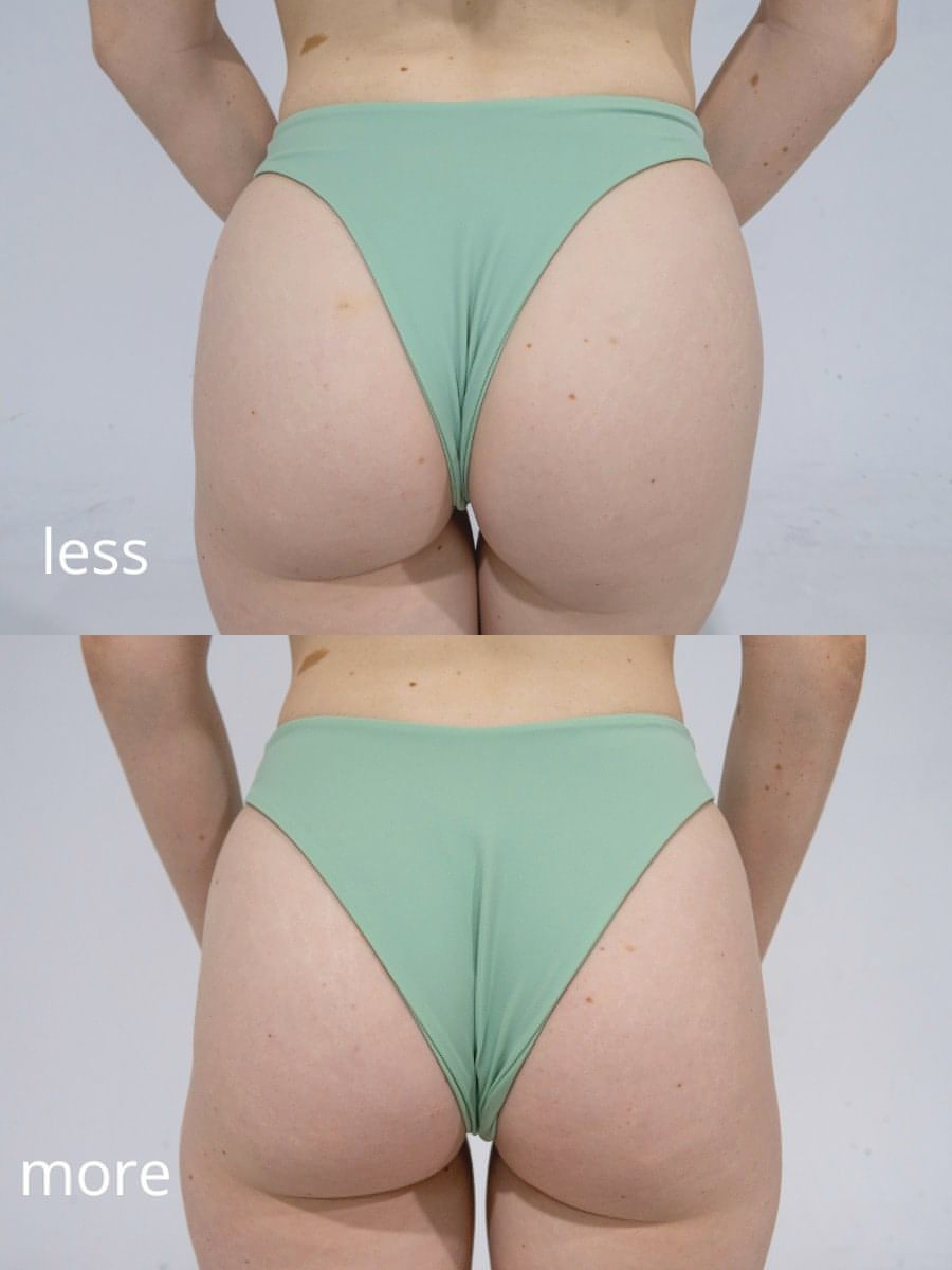 ordinary girl high leg bikini bottom - cherry kisses/strawberry dreams